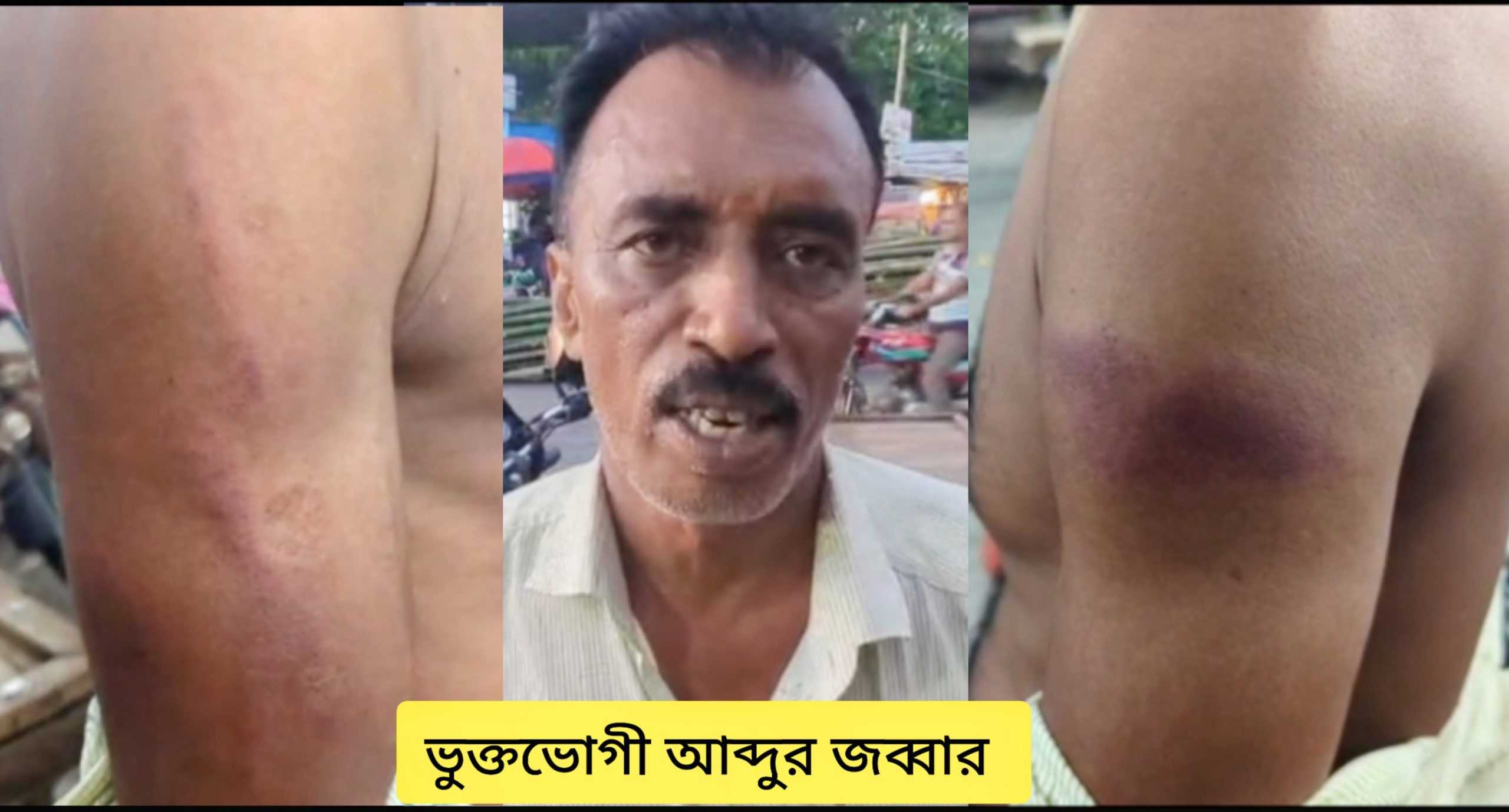 লোহাগড়ায় সিভিল পোশাকধারী (ডিবি) প্রশাসনের হাতে মোটরসাইকেল চালক মারধরের শিকার