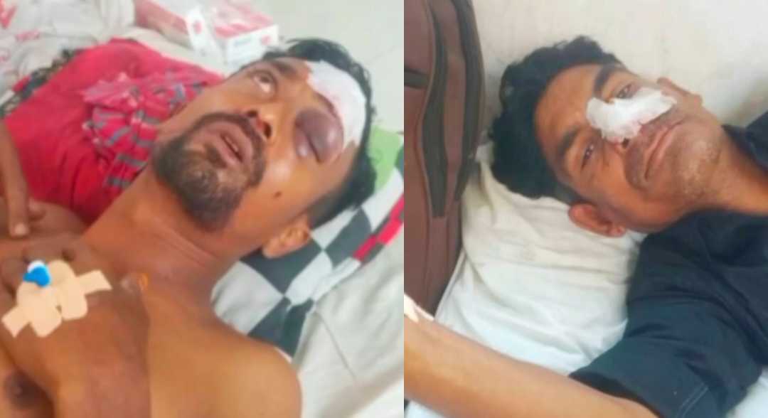 লোহাগড়ায় বিএনপির দুই গ্রুপের সংঘর্ষে ৪ জন গুরুতর আহত, মামলা দায়ের